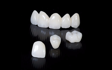 Metal Free Ceramic at GTR Dental Lab